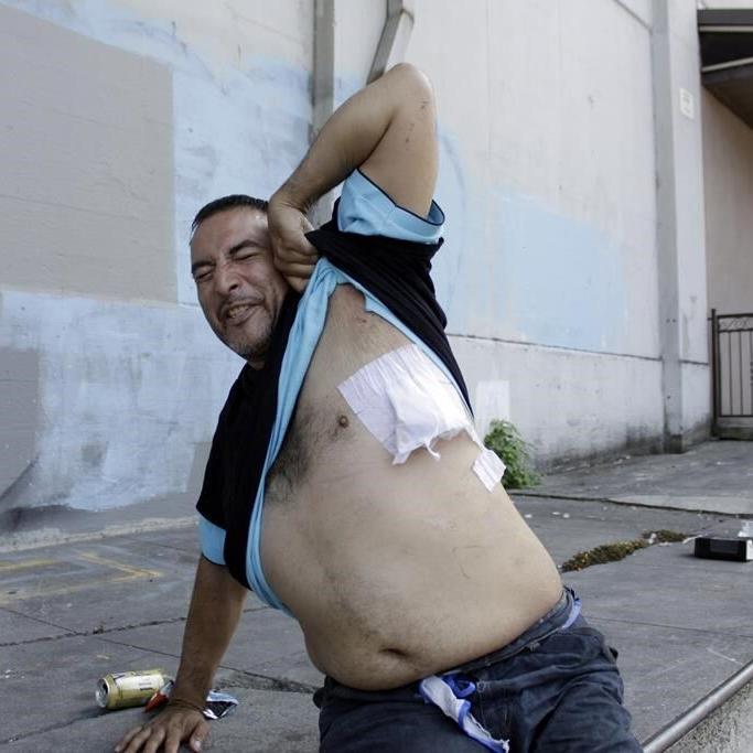 Gun injuries in US surged during pandemic, CDC study shows
